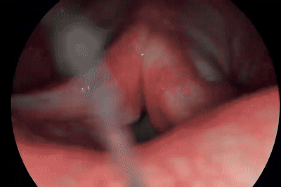 Camera Médica USB FULL HD
