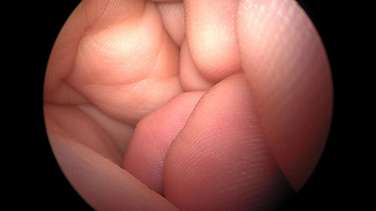 Camera MédicaIMAGE MAX